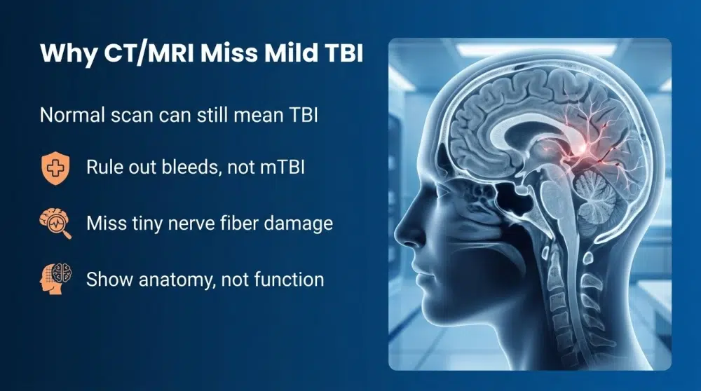 Why CT/MRI Miss Mild TBI - Normal scan can still mean TBI